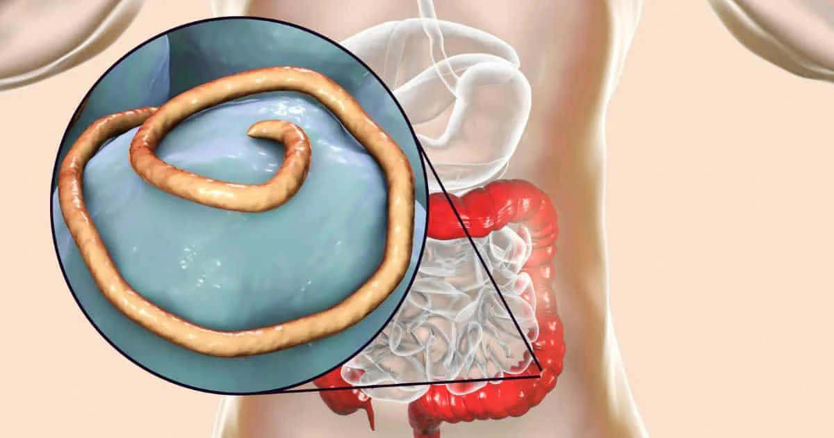 Intestinal Parasites