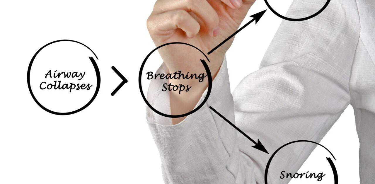 sleep apnea and metabolic syndrome
